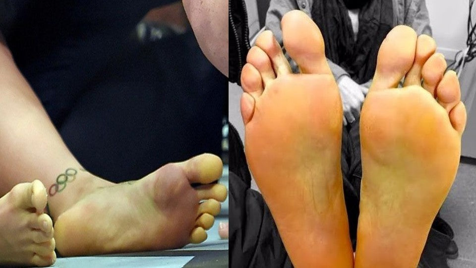 ¿Por qué tengo los pies amarillentos?,¿Qué significa?