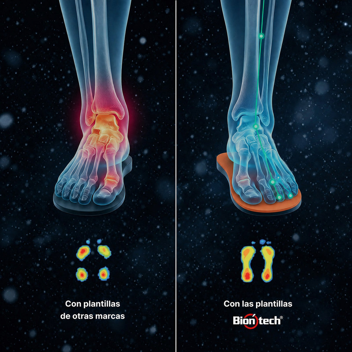 Antes y después: pisada con plantillas de otras marcas y con las plantillas Biontech